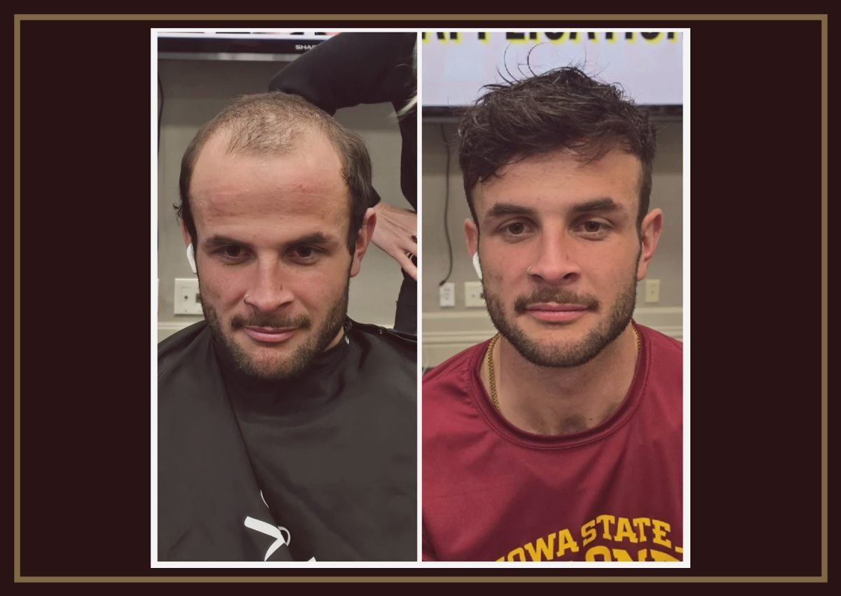 Men hair system result
